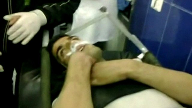 Syria Chemical Weapons Victom
